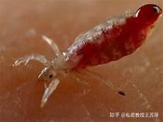 长了阴虱的症状图片